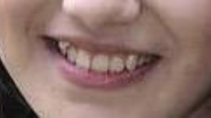 Do guys pay extra attention to a girl's teeth?