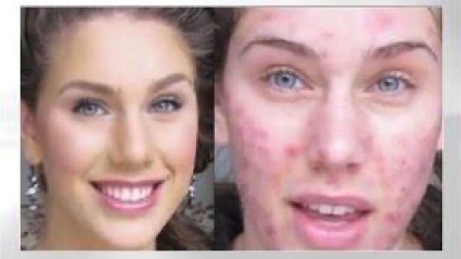 Is there such thing as a girl that is perfect 10 without makeup?