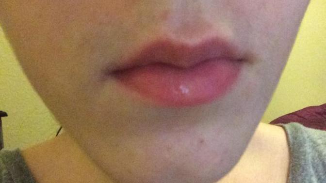 Do I have thin lips or full lips?
