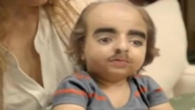Why are human babies so ugly?