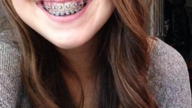 What do you think of girls with braces?