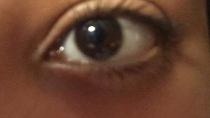 What shape is my eye?