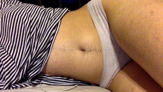 Guys:Is some hair on abdomen and butt a turn off?