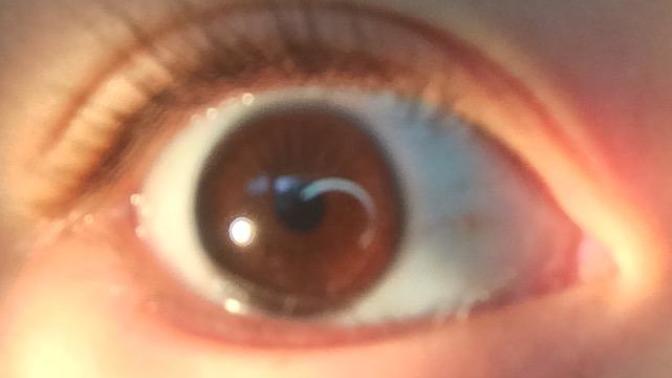 What is my eye color?