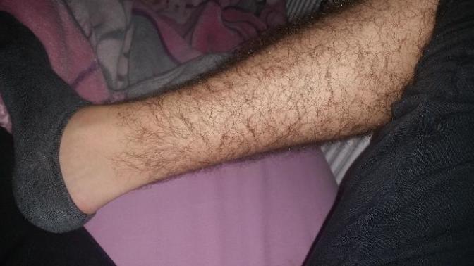 Hey GAG, My legs are hairy? Be honest?