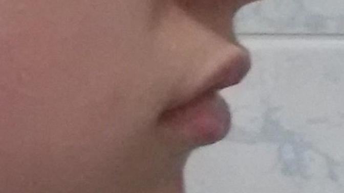 I think my chin is too small for my nose and face :( How can I get a long chin from natural ways?