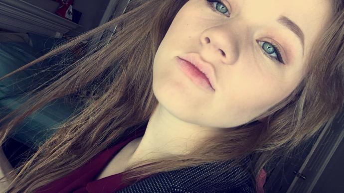 How do I get rid of my resting bitch face?