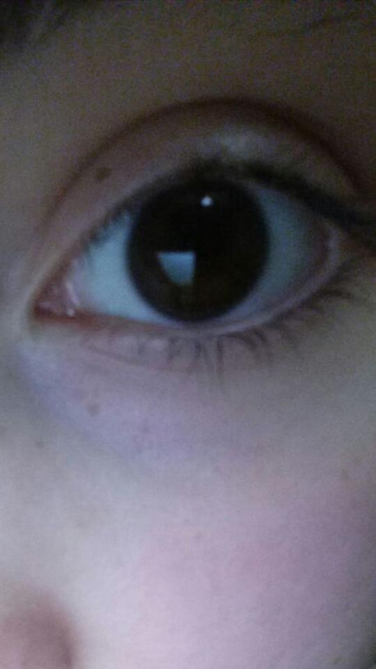 Which eye have got a more beautiful shape,lashes and why?