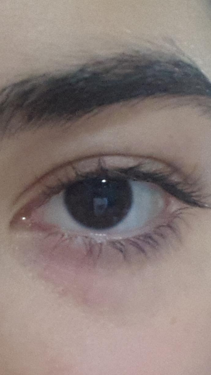 Which eye have got a more beautiful shape, lashes and why?