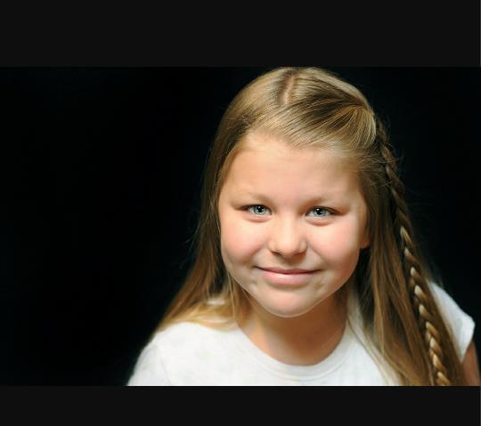 Do you have dimples? If so, where? And do you like dimples?