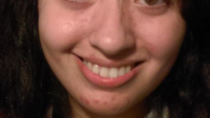 Guys, Will my acne and weight hurt my chances at finding a boyfriend when I go to university?