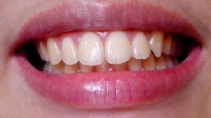 Do my teeth look okay?