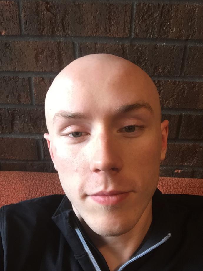Girls, under 28, would you consider me date able looks wise? (Please read the description) Could you date a guy who looked like me?