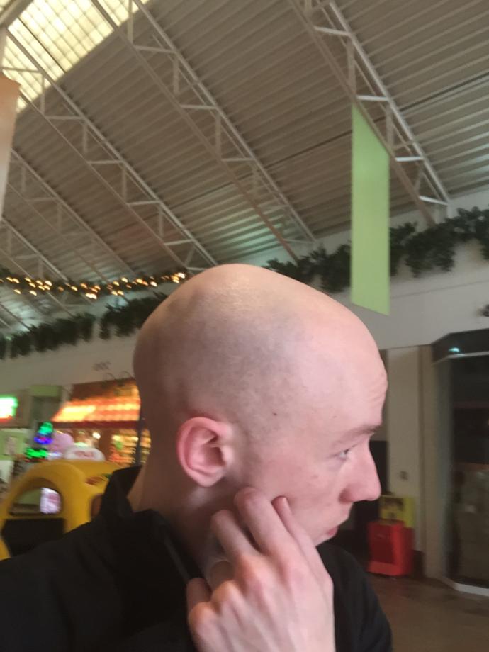 Girls, under 28, would you consider me date able looks wise? (Please read the description) Could you date a guy who looked like me?