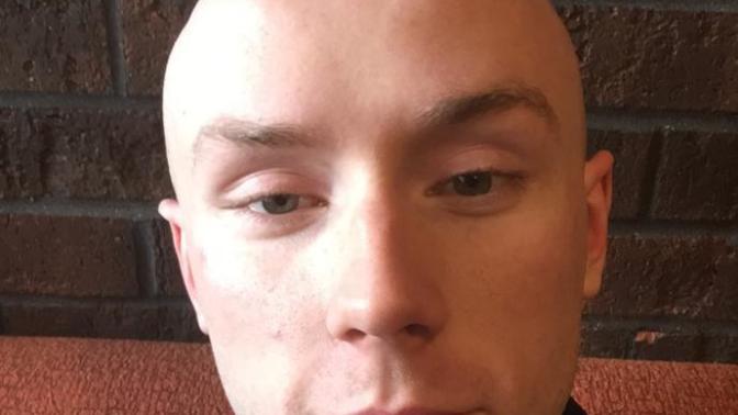 Girls, under 28, would you consider me date able looks wise? (Please read the description) Could you date a guy who looked like me?