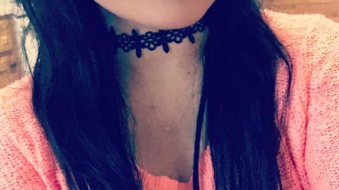 Do you like it when girls wear chokers?