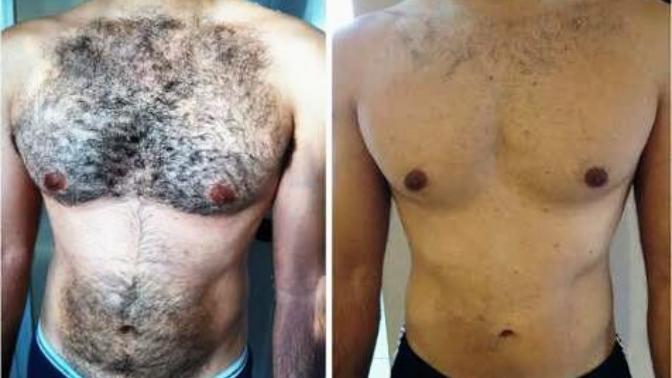 Does a man looks way better with his body hair removed?