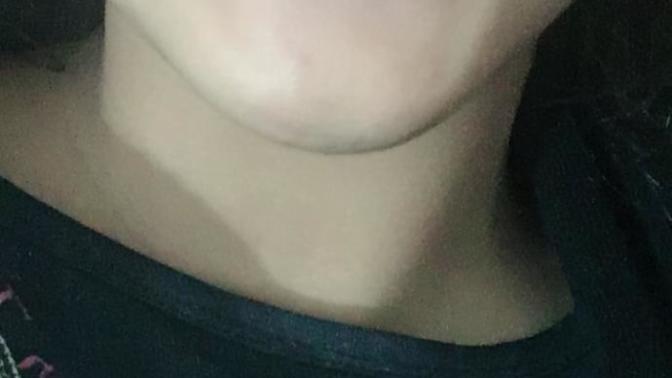 Does my teeth gap look bad?