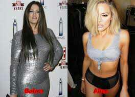 Khloe Kardashian... hard work or surgery??
