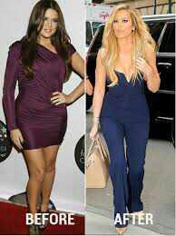 Khloe Kardashian... hard work or surgery??