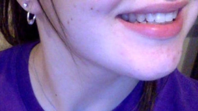 How to lose chin/facial fat?