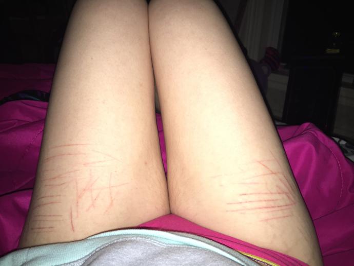 How can I stop cutting myself?