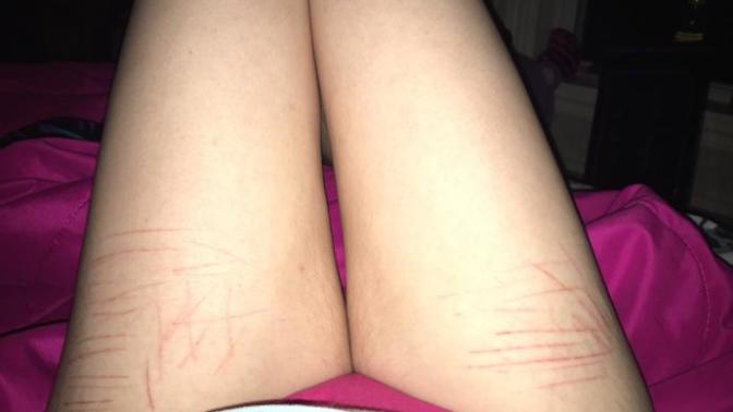 How can I stop cutting myself?