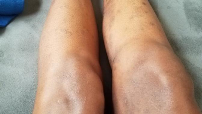 Being with a girl with scars?