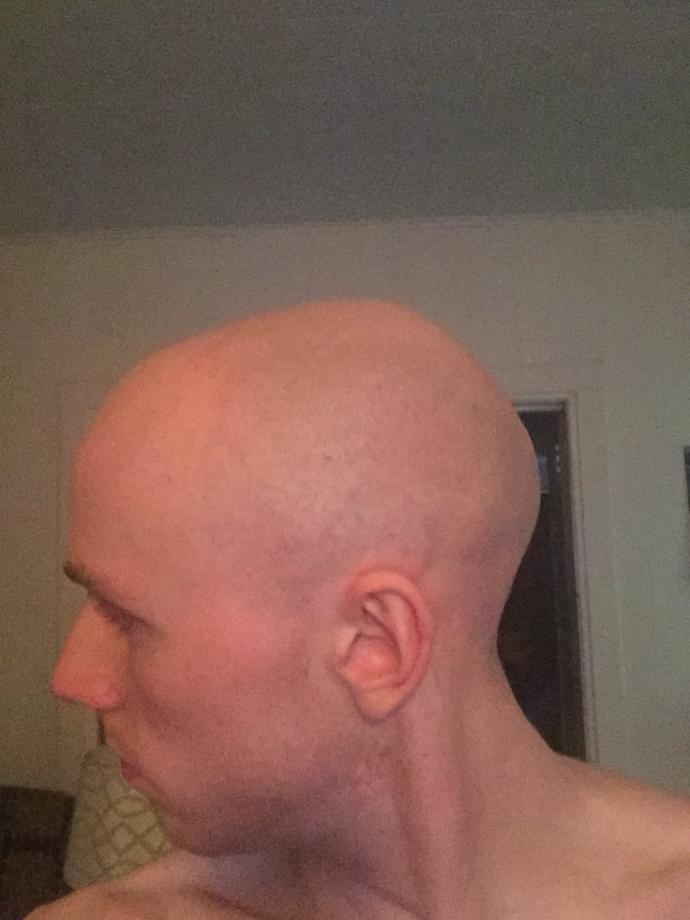 Girls, (in your 20's please) rate me? Am I attractive? Unattractive? Would I pass you looks requirement to date?