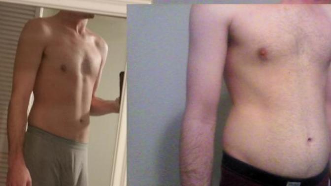 Is it normal to gain this much weight when you quit smoking?