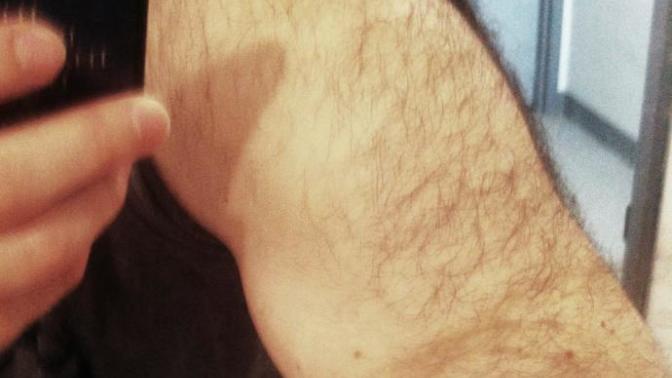 Should guys shave their legs and arms?