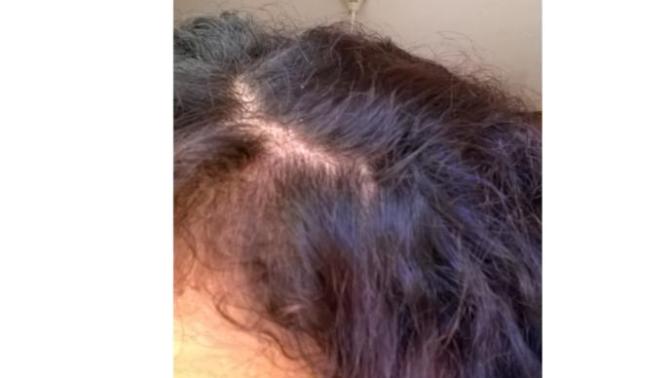 Am so angry!! Why is my hair soft and straight at the roots and curly and frizzy at the ends! Av tried many stuff. ladies?