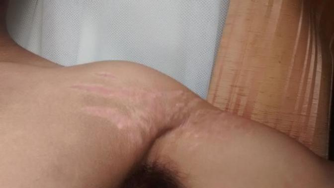 Would you find these stretch marks intimidating if I took my shirt off?