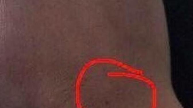 Anyone else have a freckle on their right hand or left boob?