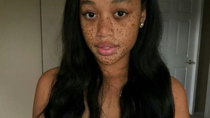 Do you think she's ugly?