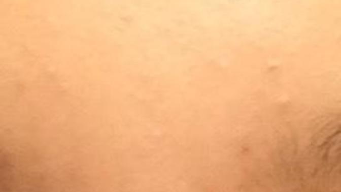 What are these and how can I get rid of it?