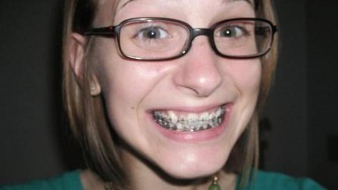 I didn't want to get braces, should I get them removed when I move out?