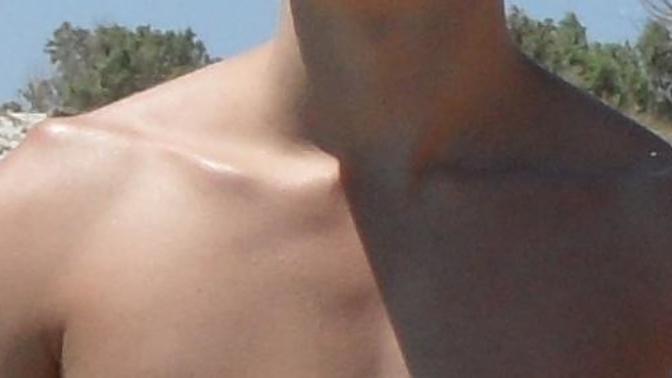 Body image issues and depression, collarbones, self-hatred?