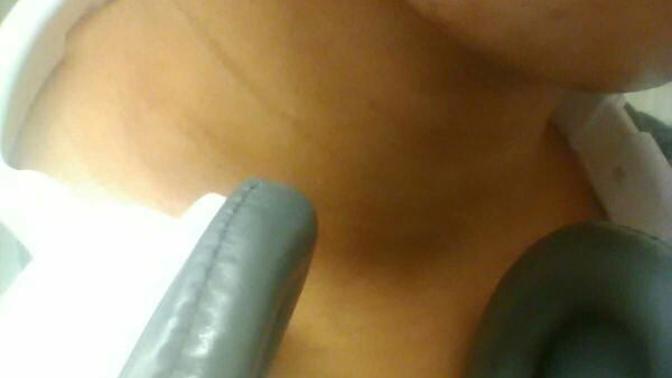 What is this on my face? Please help?