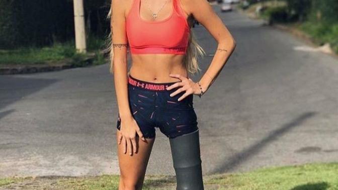 Would you date this guy/girl (prosthetic limb)?
