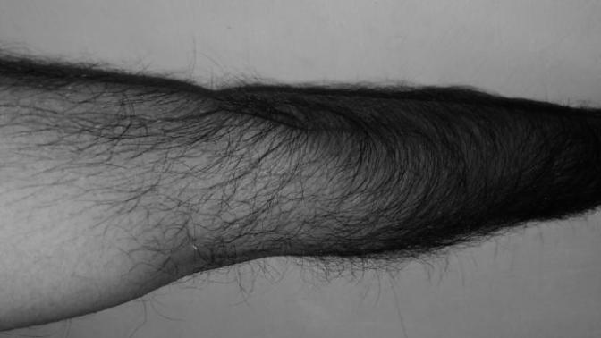 Guys and gals, would you say I am way too skinny as well as way too hairy bear and turn off?