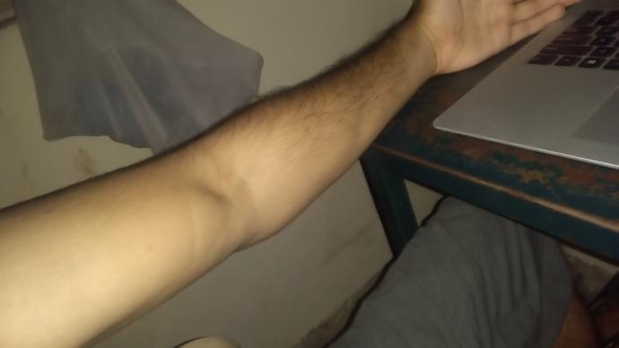 Do i look too hairy or skinny or unhealthy?