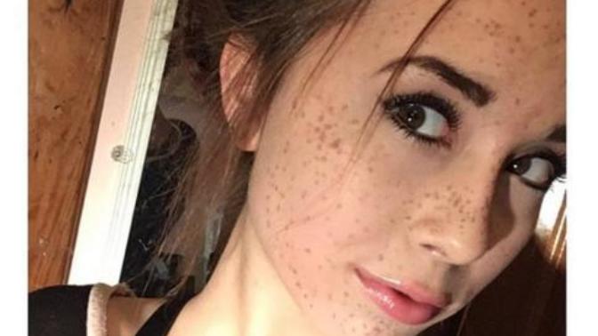 How do guys feel about girls with freckles?