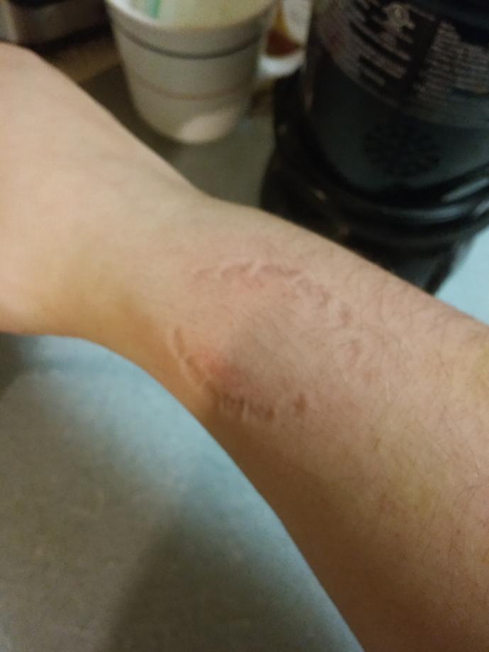 Is biting yourself fucked up?
