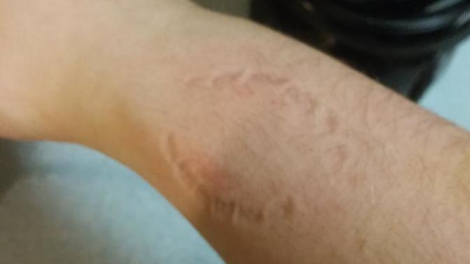Is biting yourself fucked up?
