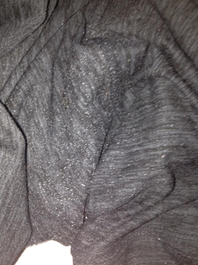 Weird white flakes in legs of pants? GirlsAskGuys