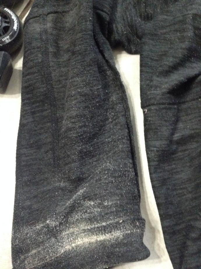 Weird white flakes in legs of pants?