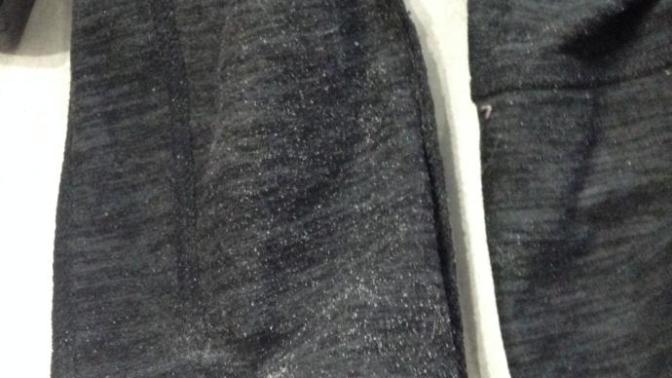 Weird white flakes in legs of pants?