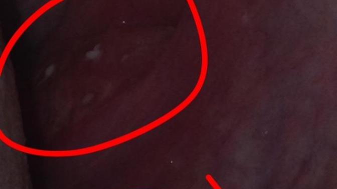 Do I have Mono?