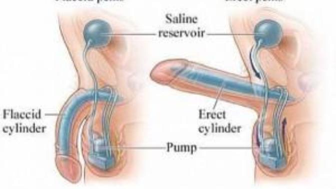 I'm about to have my balls cut open, anyone want to wish me luck?